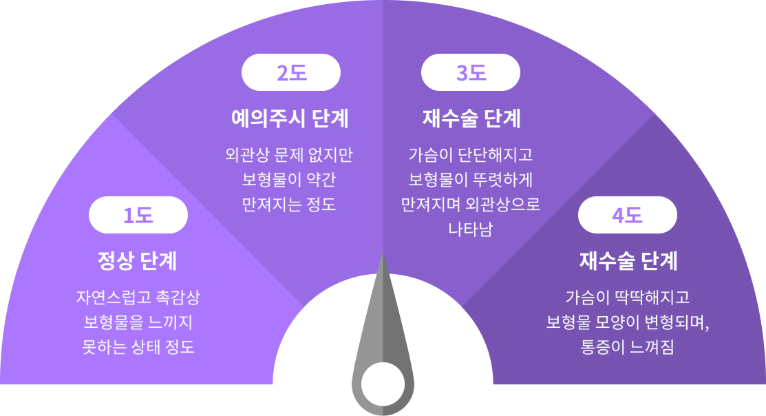 가슴 성형 수술후 가슴 구축을 평가하는 단계.