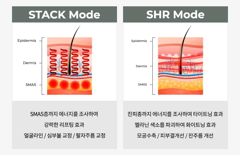 티타늄리프팅 레이저의 stack 모드와 shr모드의 효과에 대한 설명.