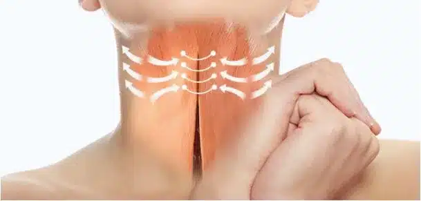 마인 미니목거상의 과정 중 하나로 목 근육을 앞쪽으로 묶어주는 것을 설명하는 이미지.