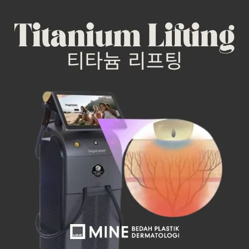 피부 전층에 열 에너지를 전달하는 티타늄리프팅.