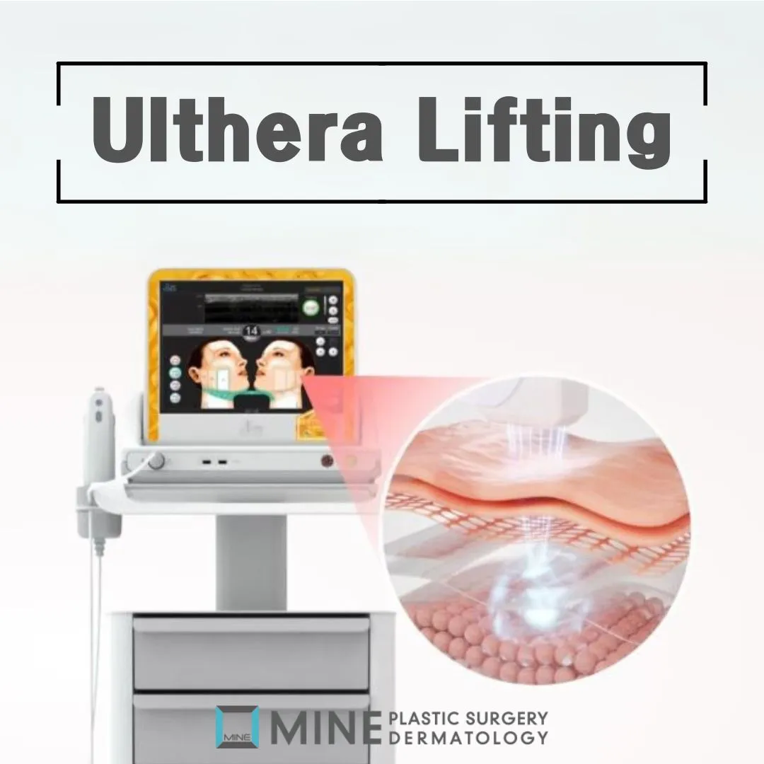 Ulthera lifting HIFU device and skin layer diagram showing focused ultrasound depth