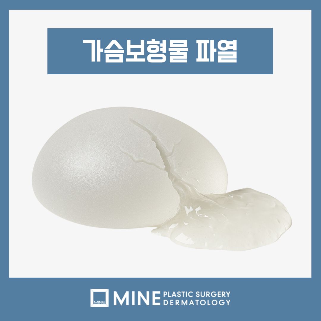 Clinical photo showing breast implant rupture symptoms