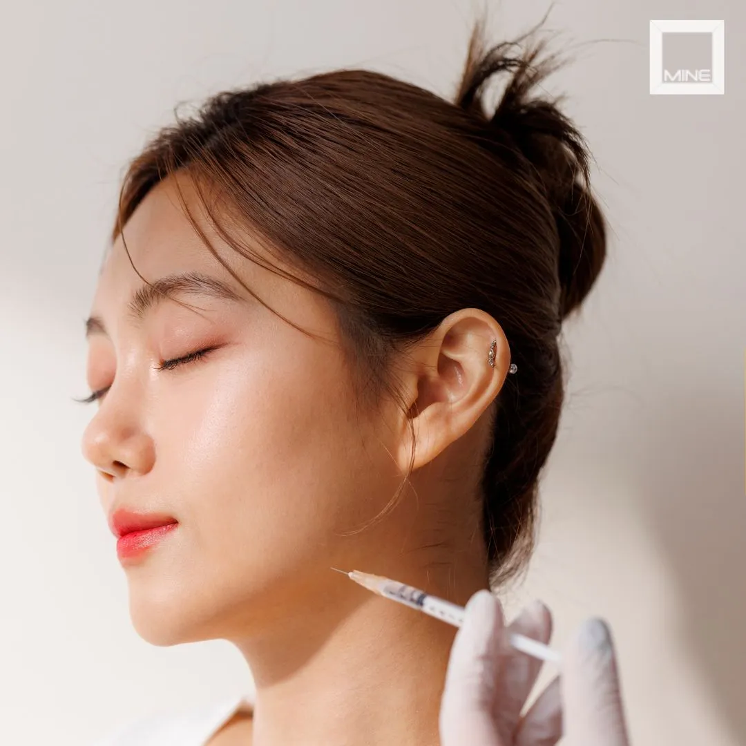 Salivary gland Botox injection procedure near the submandibular gland — salivary gland botox not working explained at MINE Plastic Surgery Seoul