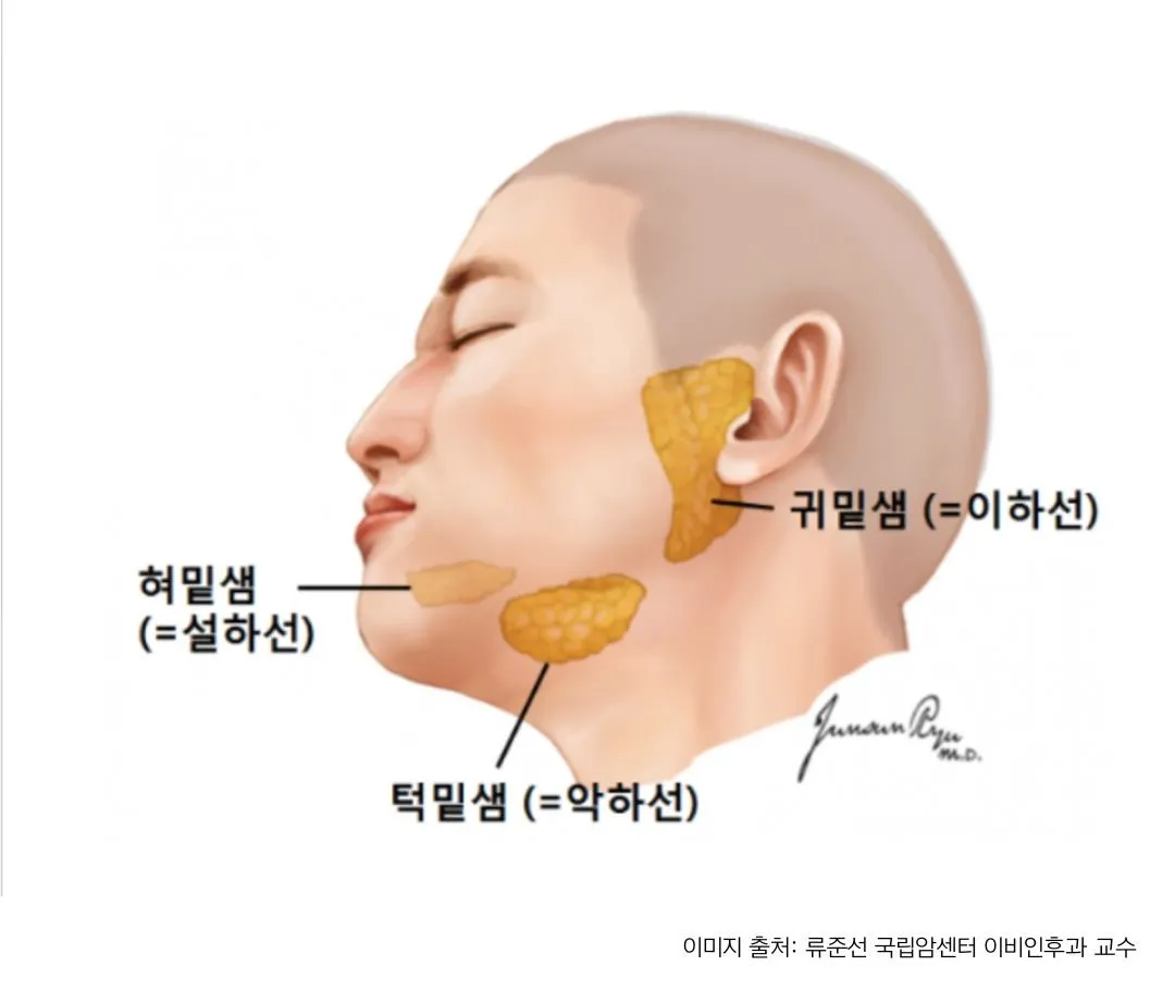 턱밑 침샘 비대 어떻게 제거할까? | 마인성형외과
