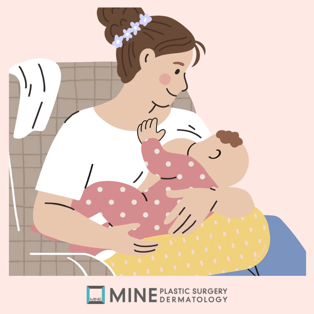 Illustration of breastfeeding considerations after nipple surgery Korea — duct-preserving technique helps protect nursing ability