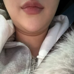 이중턱 근육묶기