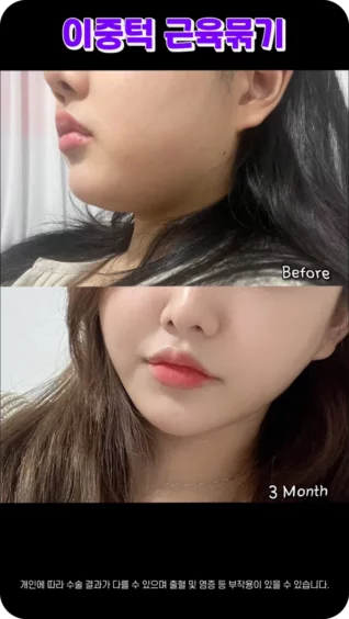 [마인 Shorts] 남들 몰래👀턱살 빼는 법? 이중턱 근육묶기