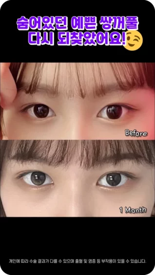 [마인 Shorts] 숨은 쌍꺼풀 찾기👀✨