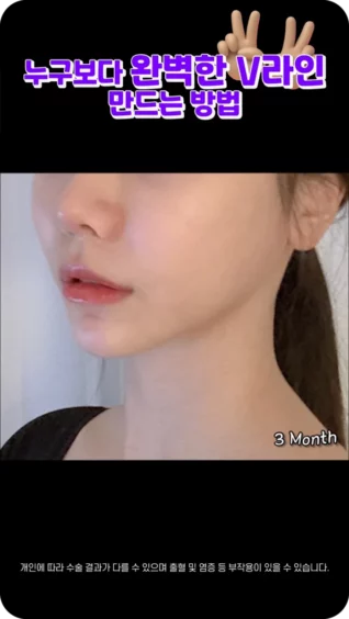 [마인 Shorts] 누구보다 완벽한 V라인 만드는 방법?