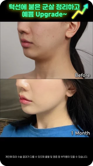 [마인 Shorts] 예쁨 Upgrade 하는 방법? 얼굴선만 정리해도 훨씬 예뻐요