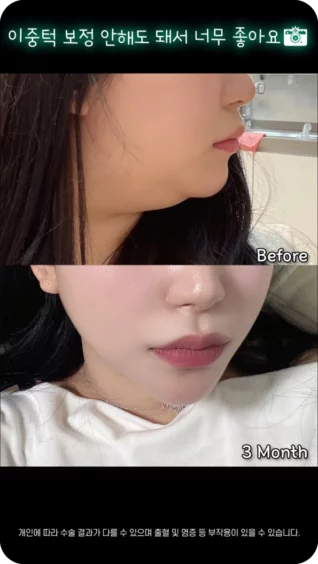 [마인 Shorts] 셀카 찍고 이중턱 보정 안해도 돼서 너~무 좋아요😍