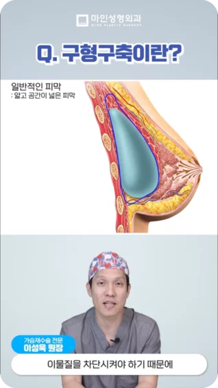 [마인 Shorts] 가슴수술의 부작용, 구형구축! 도대체 뭔가요?!