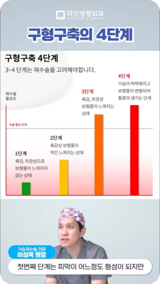 [마인 Shorts] 구형구축의 단계별 증상이 궁금해요!