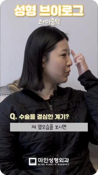 [마인 Shorts] 성형외과 직원의 코성형+이중턱근육묶기 수술 당일 후기